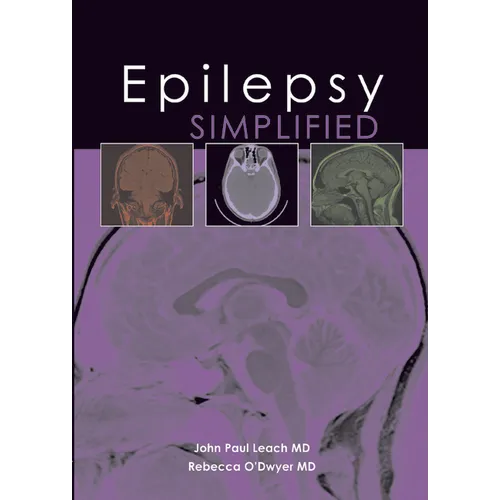 Epilepsy Simplified