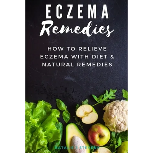 Eczema Remedies: How to Relieve Eczema With Diet & Natural Remedies