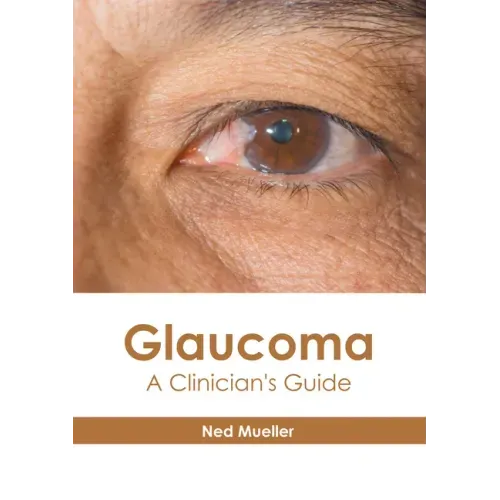 Glaucoma: A Clinician's Guide
