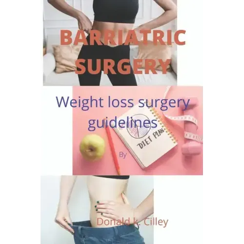 Barriatric Surgery: Weight loss surgery guidelines