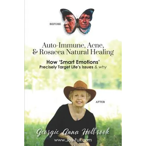 Auto-Immune, Acne, & Rosacea Natural Healing - How 'Smart Emotions' Precisely Target Life's Issues & Why