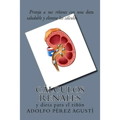 Cálculos renales: y dieta para el riñón