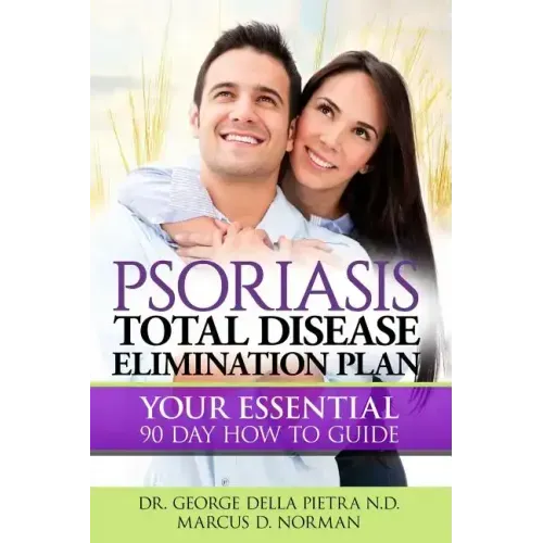 Psoriasis Total Disease Elimination Plan: It Starts with Food Your Essential Natural 90 Day How to Guide Book!