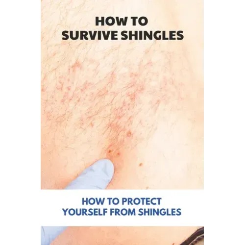 How To Survive Shingles: How To Protect Yourself From Shingles: How To Speed Up Shingles Recovery