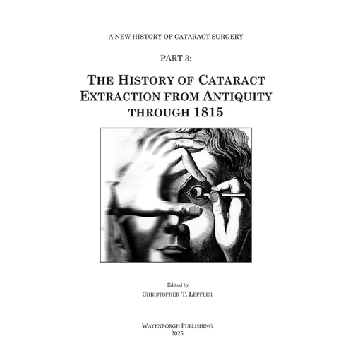The History of Cataract Extraction from Antiquity through 1815