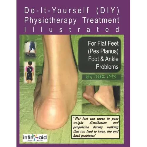 Physiotherapy Treatment Illustrated For Flat Feet (Pes Planus) Foot & Ankle Problems