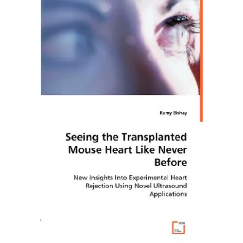 Seeing the Transplanted Mouse Heart Like Never Before