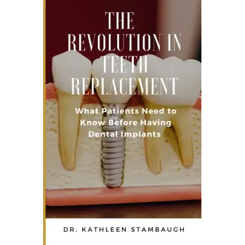 The Revolution in Teeth Replacement: What Patients Need to Know Before Having Dental Implants