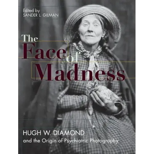 Face of Madness: Hugh W. Diamond and the Origin of Psychiatric Photography