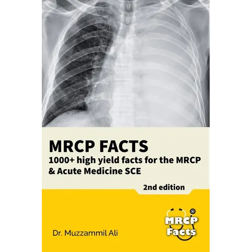 MRCP Facts: 1000+ high yield facts for the MRCP & Acute Medicine SCE exams