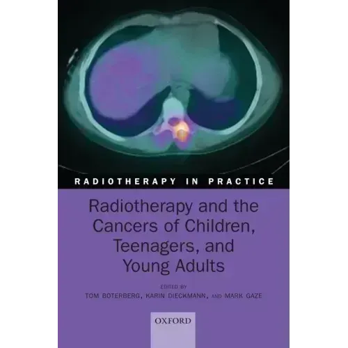 Radiotherapy and the Cancers of Children, Teenagers and Young Adults