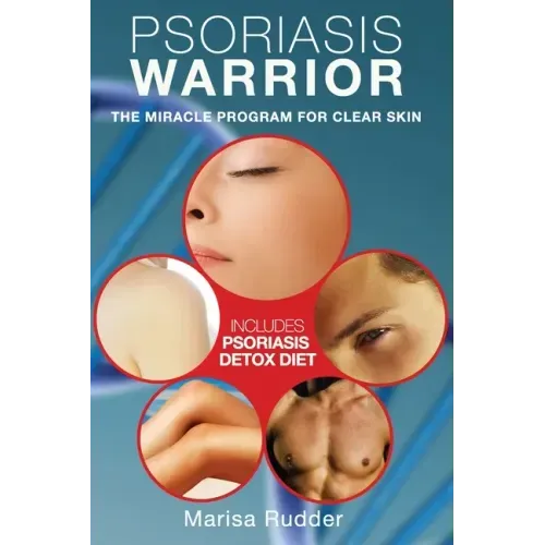Psoriasis Warrior: The Miracle Program for Clear skin