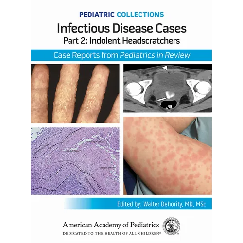 Pediatric Collections: Infectious Disease Cases: Part 2: Indolent Head Scratchers: Case Reports from Pediatrics in Review