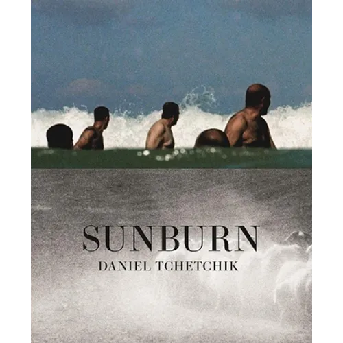 Sunburn