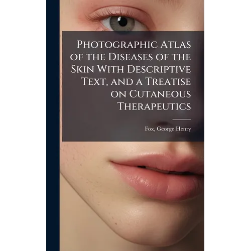Photographic Atlas of the Diseases of the Skin With Descriptive Text, and a Treatise on Cutaneous Therapeutics