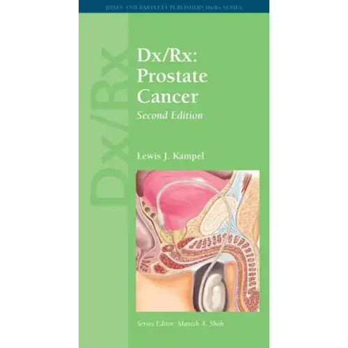 DX/Rx: Prostate Cancer: Prostate Cancer