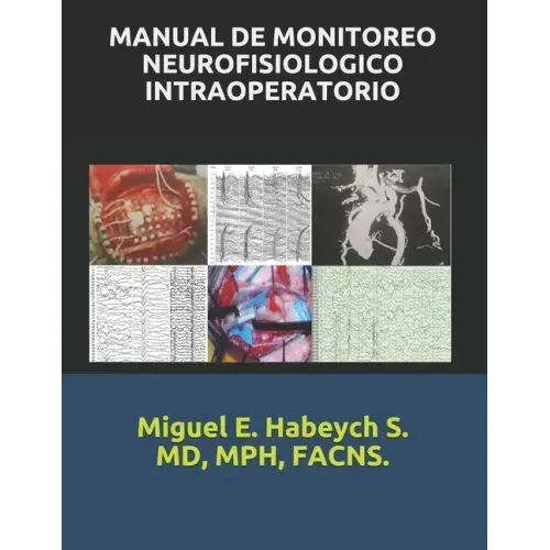Manual de Monitoreo Neurofisiológico Intraoperatorio.