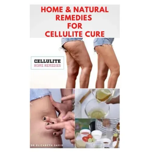 Home & Natural Remedies for Cellulite Cure: Practical Guide On The Best Remedies To Get Rid Of Your Cellulite: Everything You Need To Know