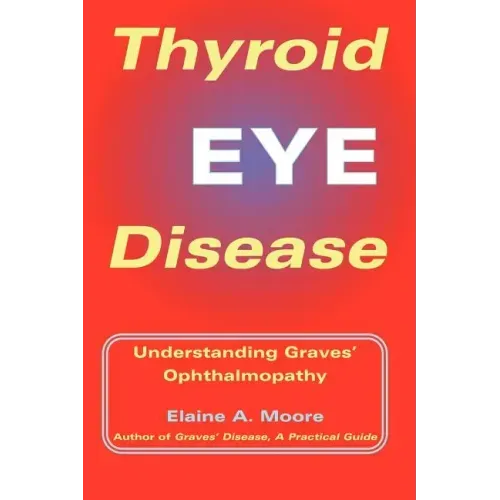 Thyroid Eye Disease: Understanding Graves' Ophthalmopathy