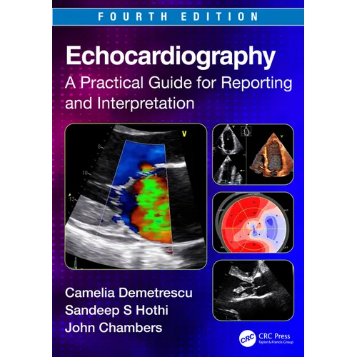 Echocardiography: A Practical Guide for Reporting and Interpretation
