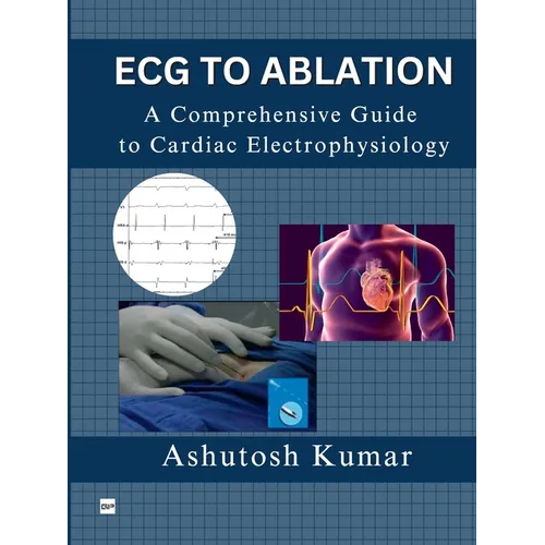 ECG to Ablation: A Comprehensive Guide to Cardiac Electrophysiology