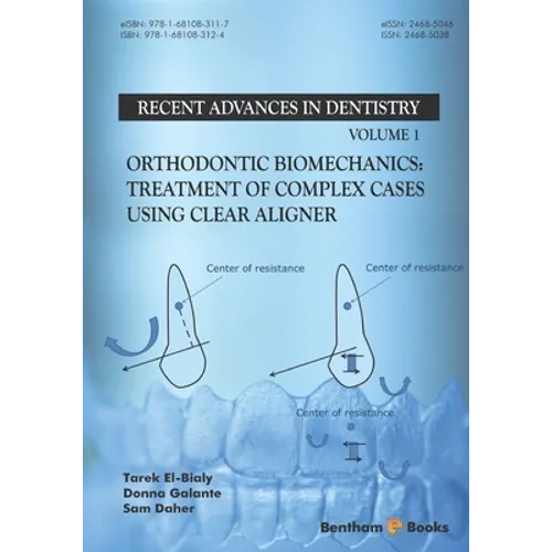 Orthodontic Biomechanics: Treatment Of Complex Cases Using Clear Aligner