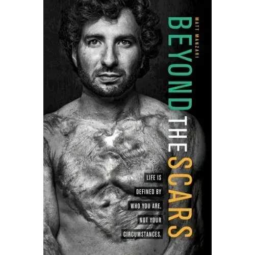 Beyond the Scars: Life Is Defined by Who You Are, Not Your Circumstances