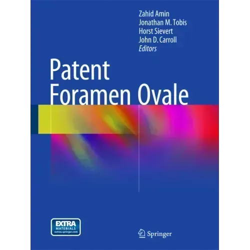 Patent Foramen Ovale