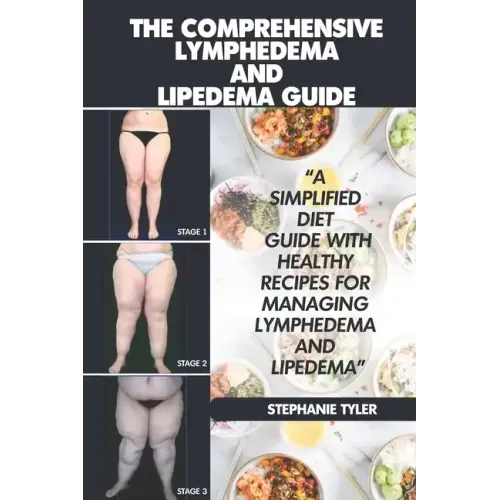 The Comprehensive Lymphedema and Lipedema Guide: The Comprehensive Lymphedema and Lipedema Guide