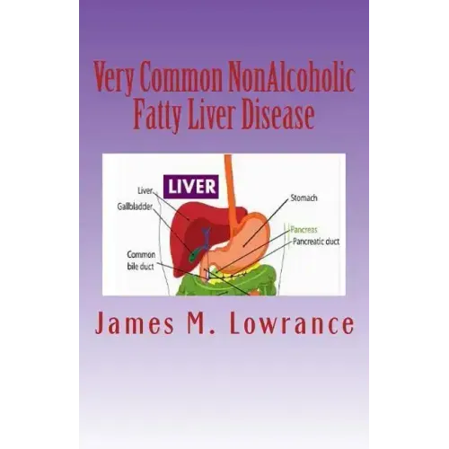 Very Common NonAlcoholic Fatty Liver Disease: How To Know if You Have Hepatic Steatosis