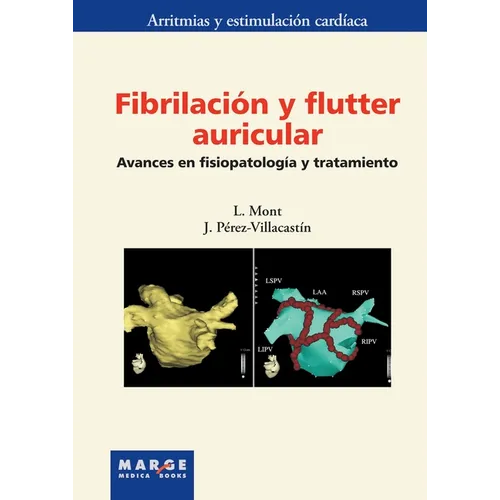 Fibrilación y flutter auricular: Avances en fisiopatología y tratamiento