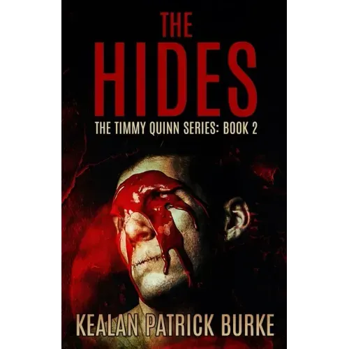 The Hides