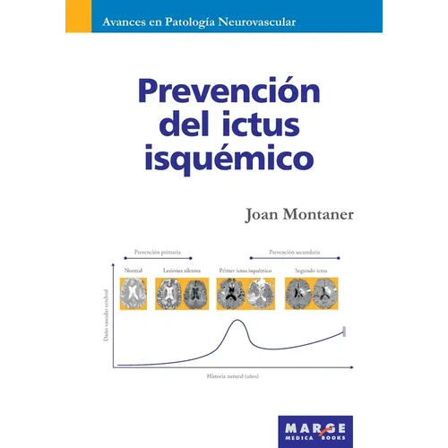Prevención del ictus isquémico