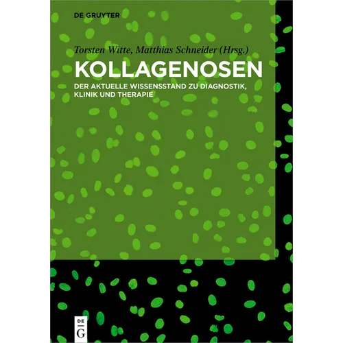 Kollagenosen: Der Aktuelle Wissensstand Zu Diagnostik, Klinik Und Therapie