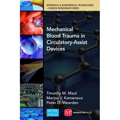 Mechanical Blood Trauma in Circulatory-Assist Devices