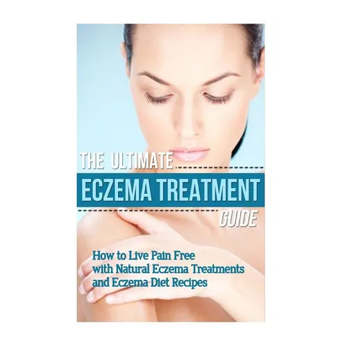 The Ultimate Eczema Treatment Guide: How to Live Pain Free with Natural Eczema Treatments and Eczema Diet Recipes