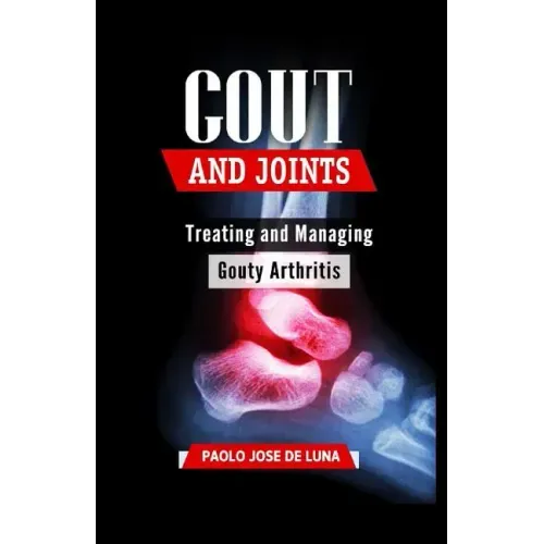 Gout And Joints: Treating and Managing Gouty Arthritis