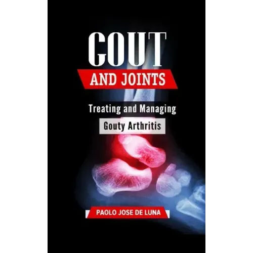 Gout and Joints: Treating and Managing Gouty Arthritis
