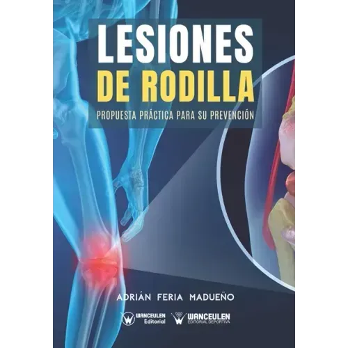 Lesiones de rodilla: Propuesta práctica para su prevención