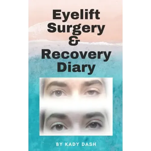 Eyelift Surgery and Recovery Diary: Ptosis, eyelifts, punctal plugs, and dry eyes