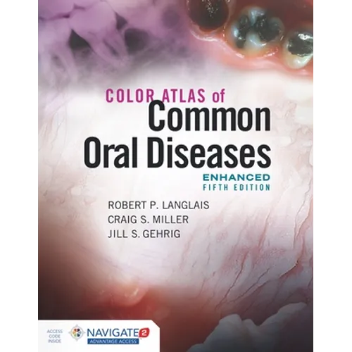 Color Atlas of Common Oral Diseases, Enhanced Edition