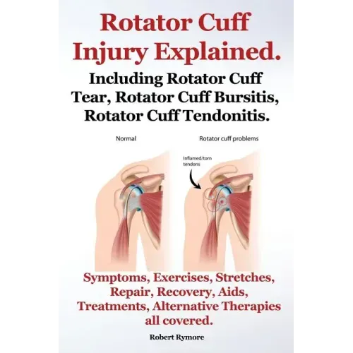 Rotator Cuff Injury Explained. Including Rotator Cuff Tear, Rotator Cuff Bursitis, Rotator Cuff Tendonitis. Symptoms, Exercises, Stretches, Repair, Re