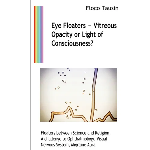 Eye Floaters - Vitreous Opacity or Light of Consciousness?: Floaters between Science and Religion, A challenge to Ophthalmology, Visual Nervous System