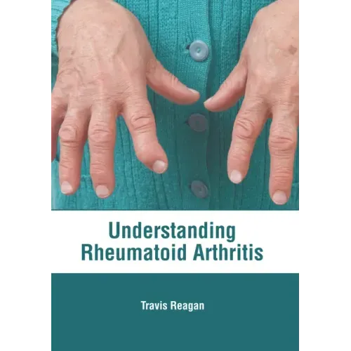 Understanding Rheumatoid Arthritis