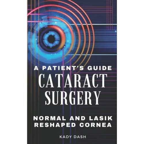 A Patient's Guide to Cataract Surgery: Normal and LASIK Reshaped Cornea