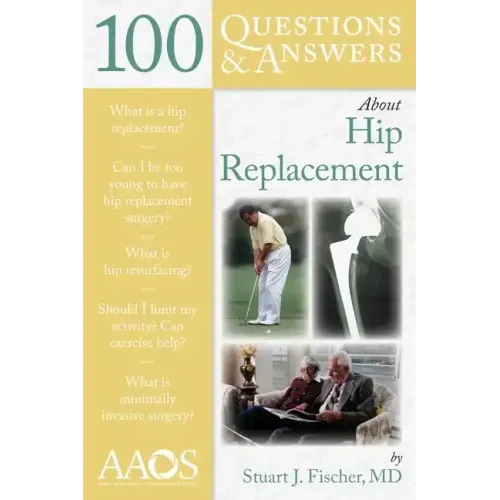 100 Questions & Answers about Hip Replacement