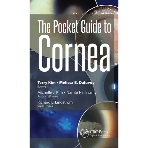 The Pocket Guide to Cornea