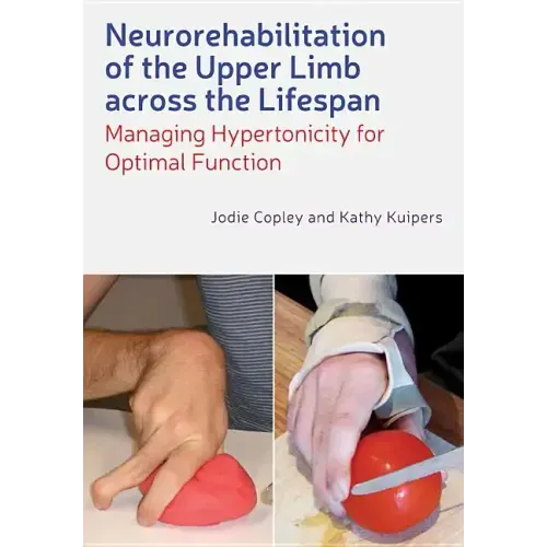 Neurorehabilitation of the Upper Limb Across the Lifespan