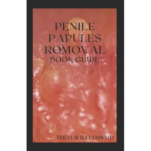 Penile Papules Romoval Book Guide: The Ultimate Guide On How To Remove Pearly Penile Papules Using Natural Remedies