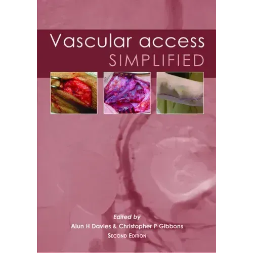 Vascular Access Simplified; Second Edition